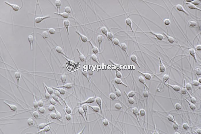 Spermatozoïdes de la Moule (Mytilus edulis) x280 - gryphea.org